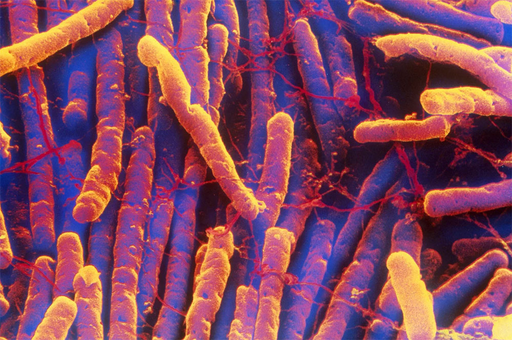 Las infecciones difusas están disminuyendo gracias a una mejor limpieza y menos antibióticos